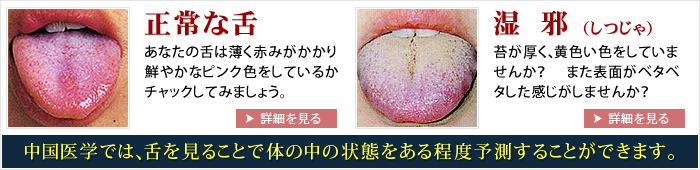 舌診-1