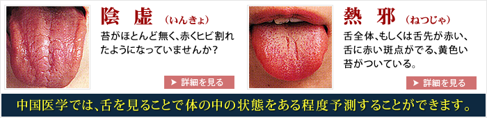 舌診-2