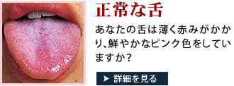 正常な舌