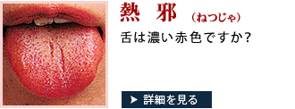 あなたの舌は熱邪かも