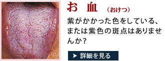あなたの舌はお血かも