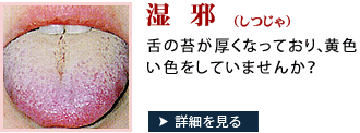 あなたの舌は湿邪かも