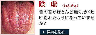 あなたの舌は陰虚かも